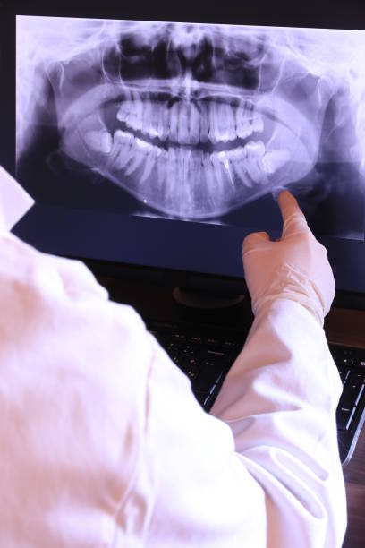 Best Emergency Wisdom Teeth Removal in Shell Valley, ND