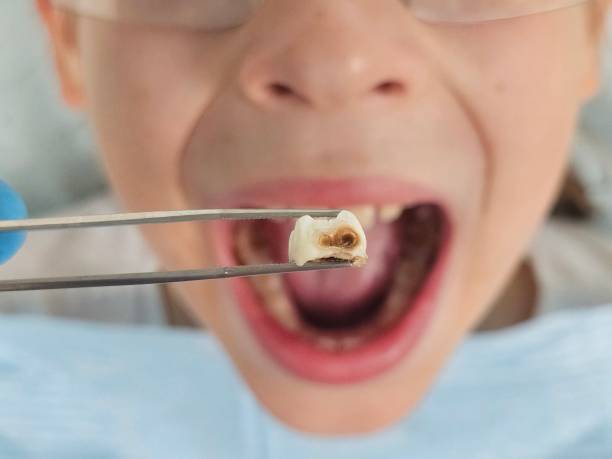 Best 24-Hour Emergency Dentist in Shell Valley, ND