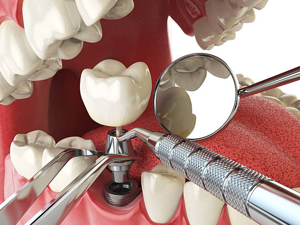 Best Emergency Treatment for Toothache in Shell Valley, ND